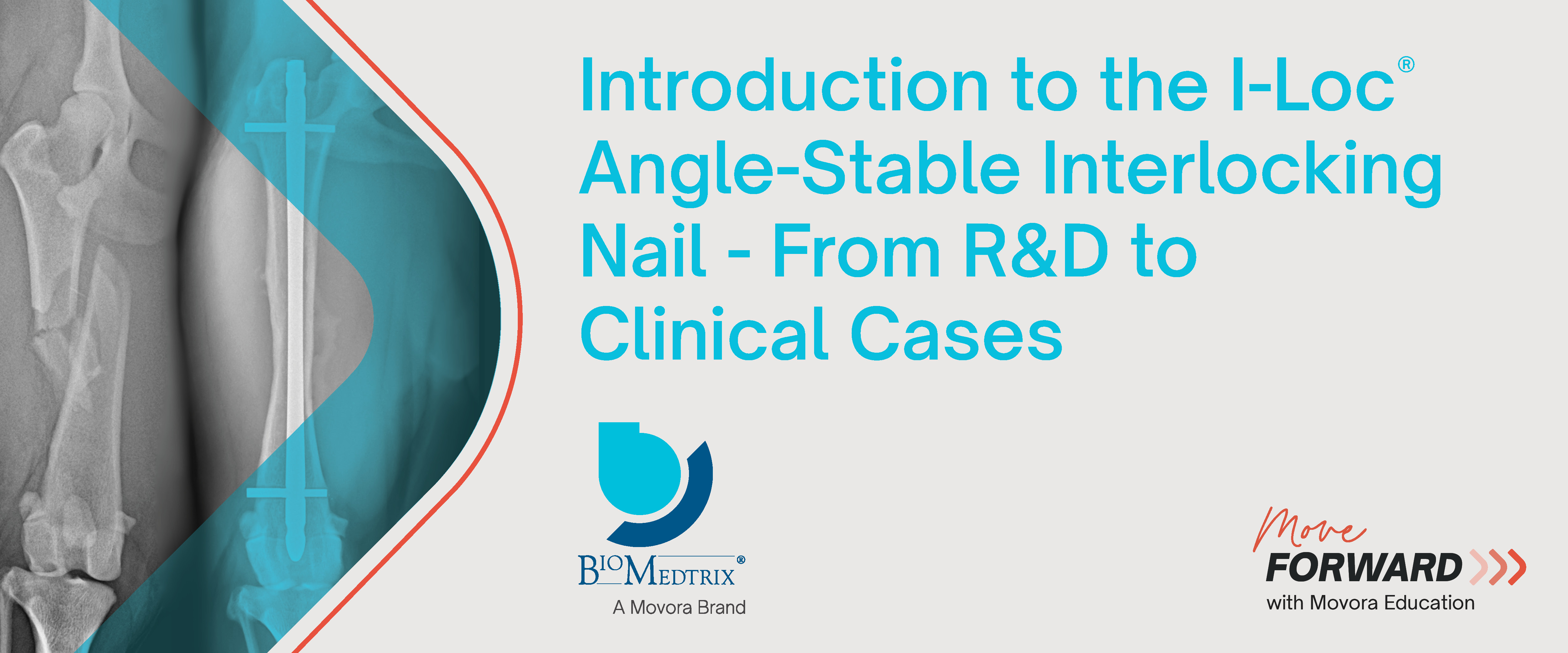 Introduction to the I-Loc Angle-Stable Interlocking nail - banner